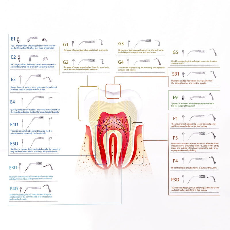Ponta De Ultrassom (Periodontia)